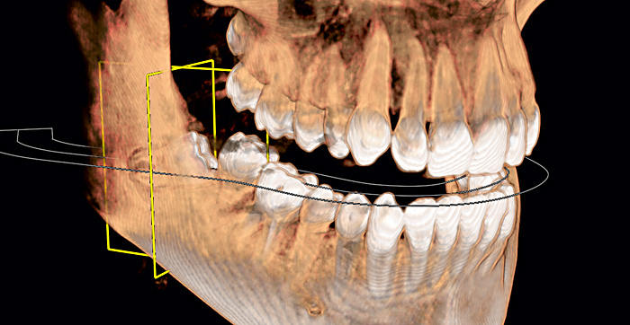 Präzise Diagnose durch modernste Technik bei Dr. Börner in Grünwald