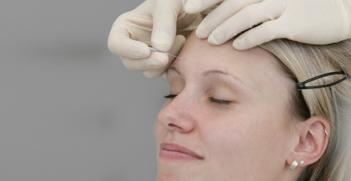 Akupunktur bei Ihrem Oralchirurgen in Grünwald